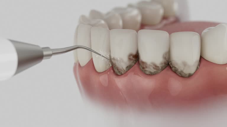 Reliable Emergency Dentist contractor in Wadena, MN by Smile Center Dentistry